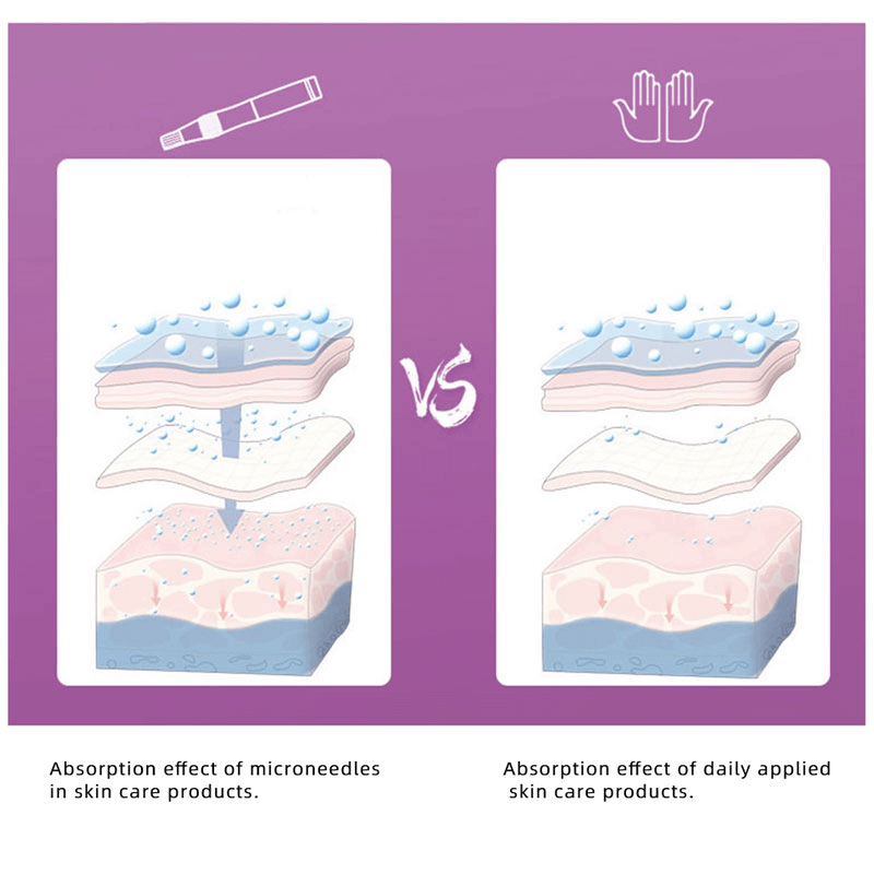 Professioneller Derma Pen mit Nano-Nadeln