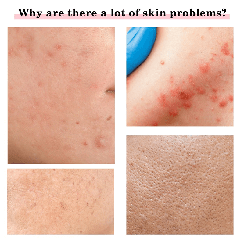 Multifunktions-Gesichtspflege-Massagegerät Anti Aging