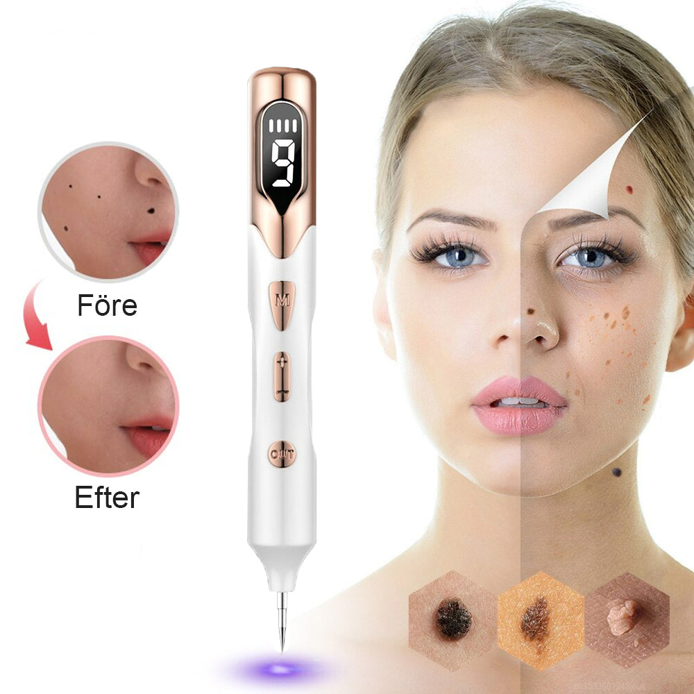 Plasma-Stift zur Entfernung von Hautmarkierungen