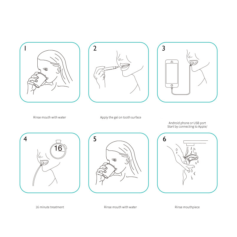 USB Smart Teeth Whitening Kit mit LED-Licht Blaulicht