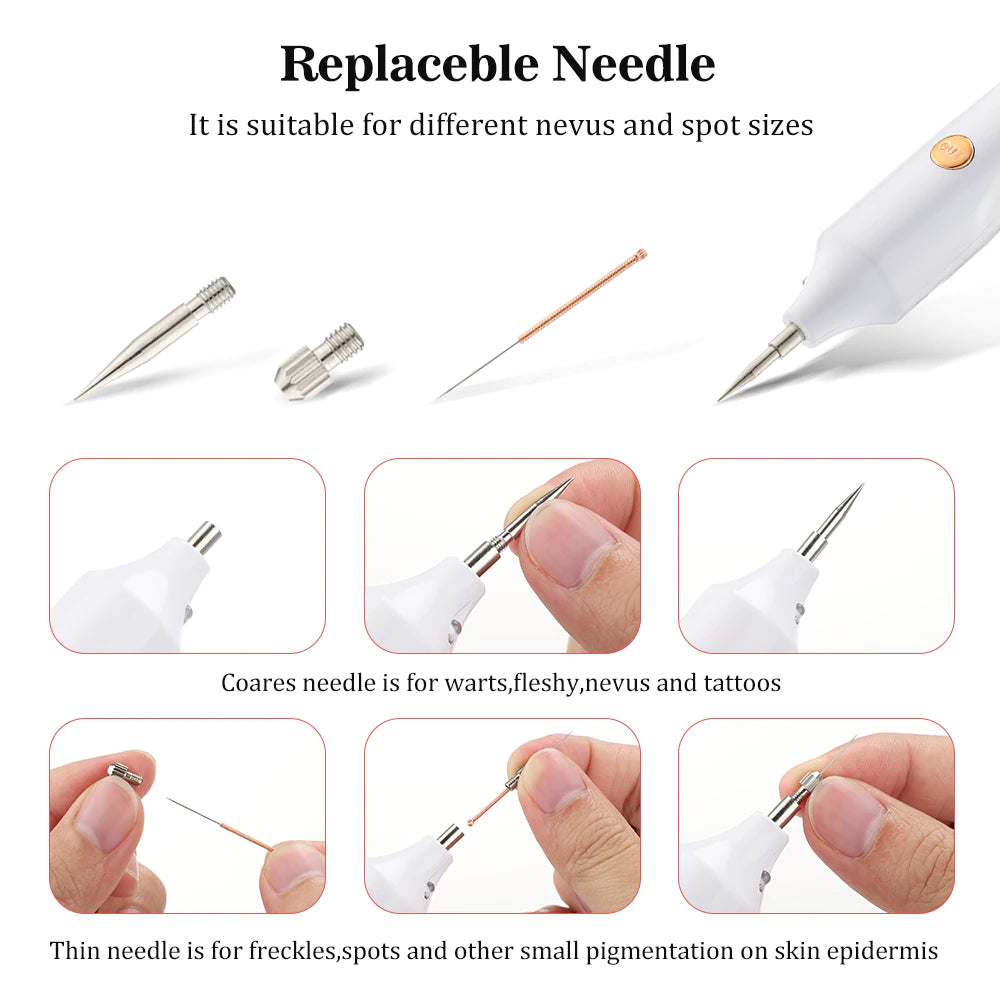 Plasma-Stift zur Entfernung von Hautmarkierungen