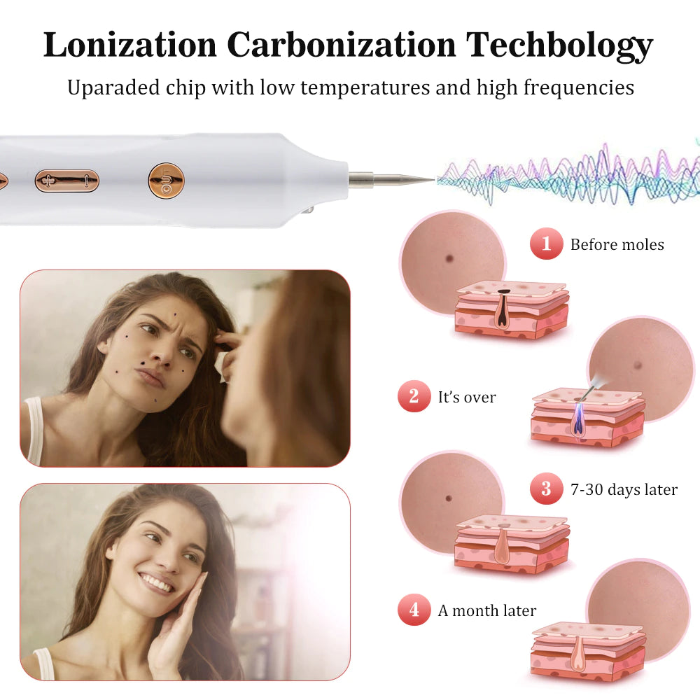 Plasma-Stift zur Entfernung von Hautmarkierungen