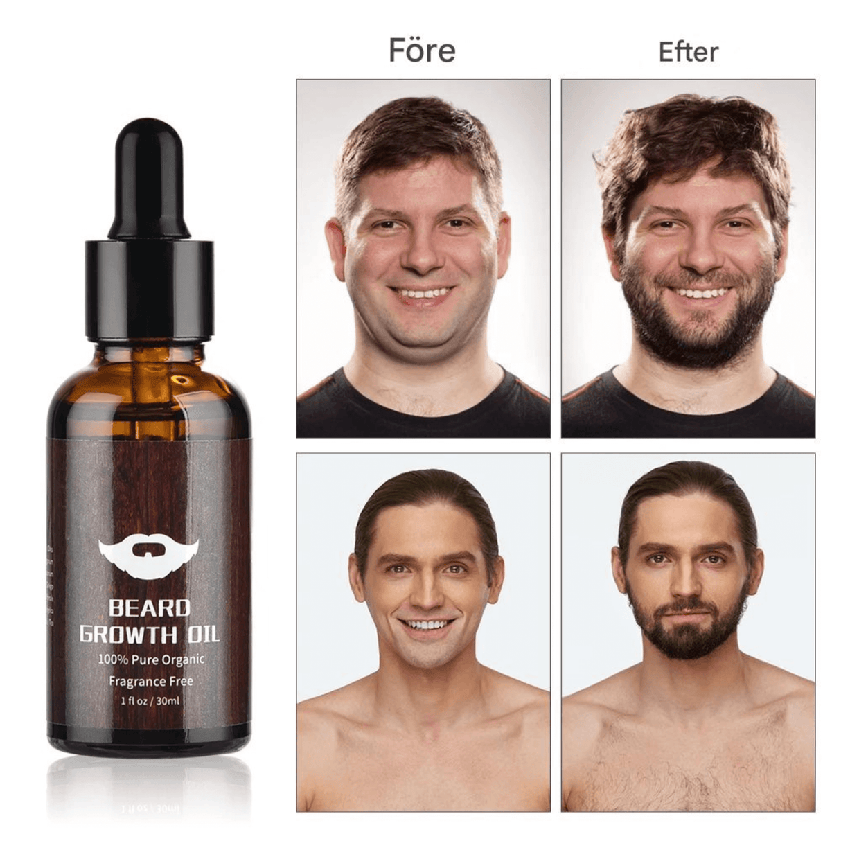 BeardPeak - Bartpflege-Set mit Öl, Balsam, Mikro-Nadel-Roller & Kamm für einen gepflegten Bart