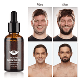 BeardPeak - Bartpflege-Set mit Öl, Balsam, Mikro-Nadel-Roller & Kamm für einen gepflegten Bart